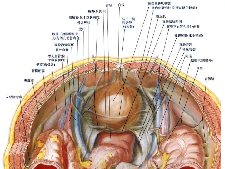 腹腔镜篇腹股沟疝手术