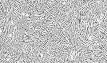 脂肪間充質干細胞.jpg