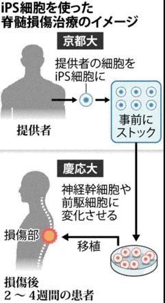 世界首例 日本批准使用iPS干细胞治疗脊髓损伤的试验