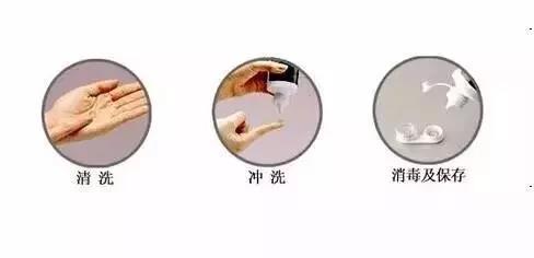 隐形守护者——润诺明隐形眼镜护理液 隐形守护者——润诺明隐形眼镜护理液