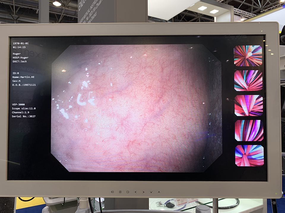 Huger launches FHD 3000 series in Medica 2018