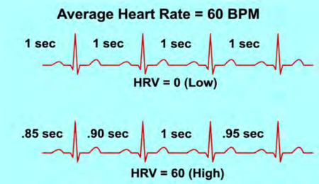 心率变异性（HRV）介绍