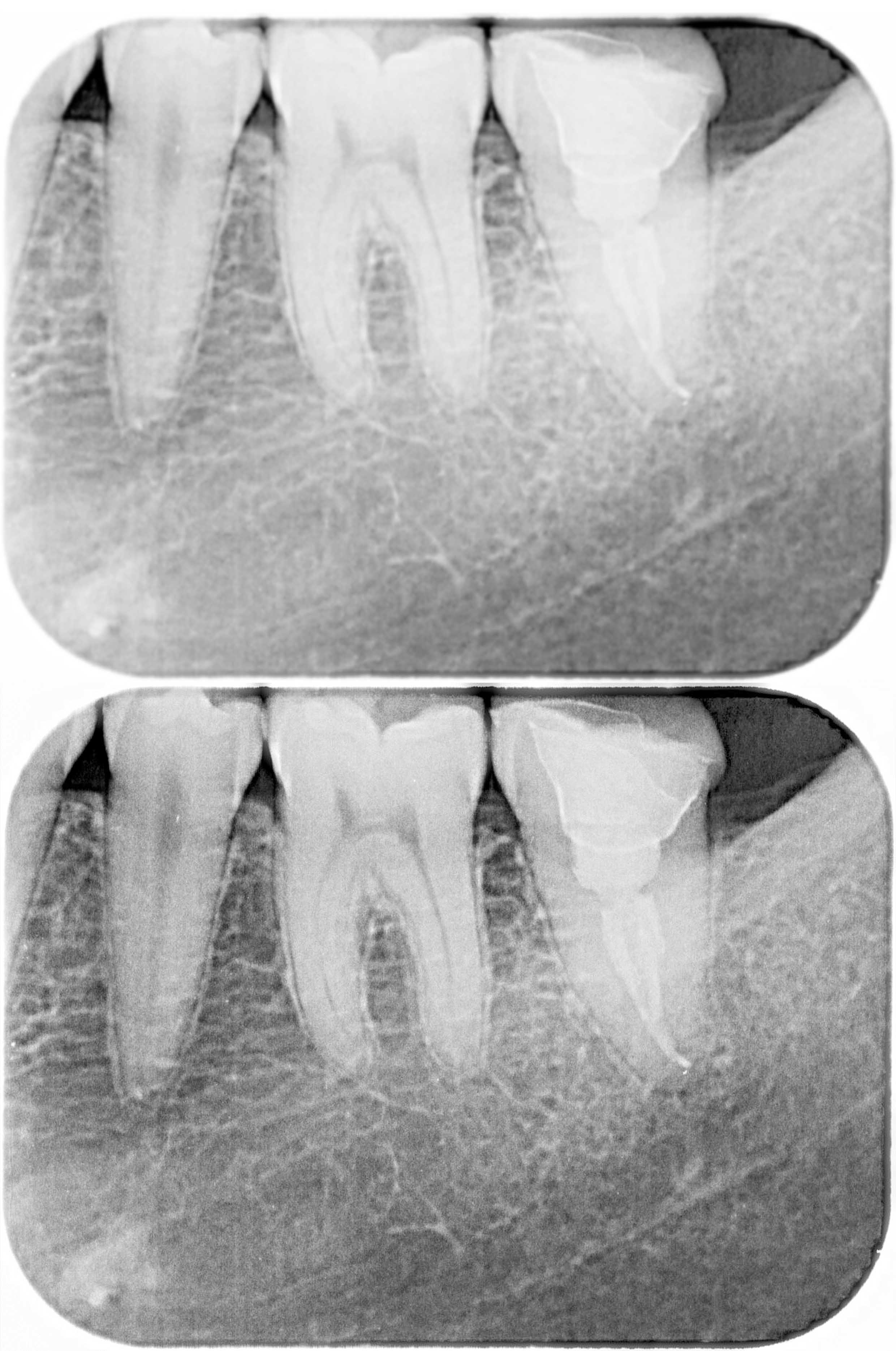 牙科CR影像扫描系统 TR100系列