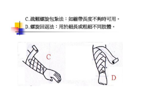 户外拓展训练时受伤该如何包扎?绷带包扎的方法介绍 户外拓展训练时受伤该如何包扎?绷带包扎的方法介绍