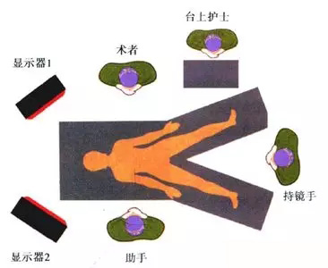 【腹腔镜篇】结直肠癌手术的入路图解 【腹腔镜篇】结直肠癌手术的入路图解