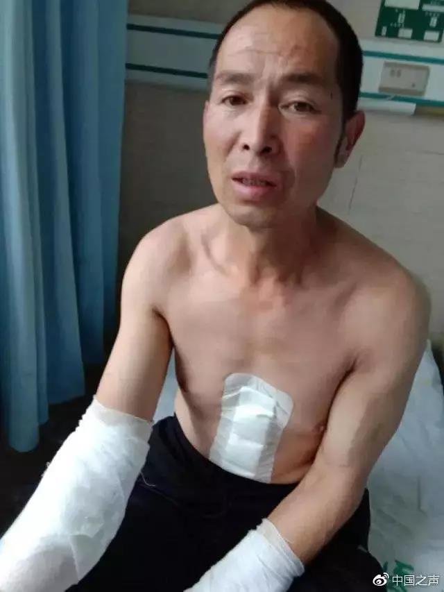 雄远荐读 ▏检察机关深度剖析“河北涞源反杀案”为什么不起诉 雄远荐读 ▏检察机关深度剖析“河北涞源反杀案”为什么不起诉