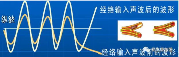 为什说经络阻塞是万病之源呢 .txt 为什说经络阻塞是万病之源呢 .txt