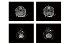 MRI equipment site