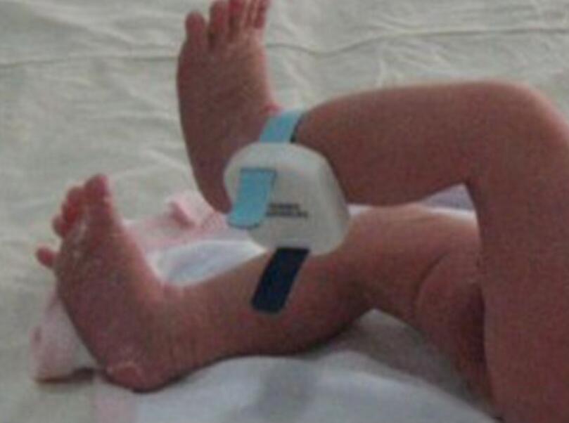 RFID智能腕带婴儿识别医院防盗系统安全可靠
