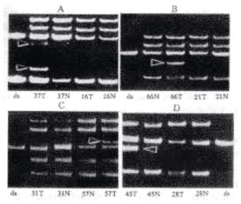 PCR