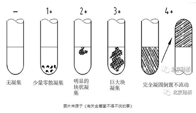 簡述血漿凝固酶試驗(yàn)的原理與操作流程