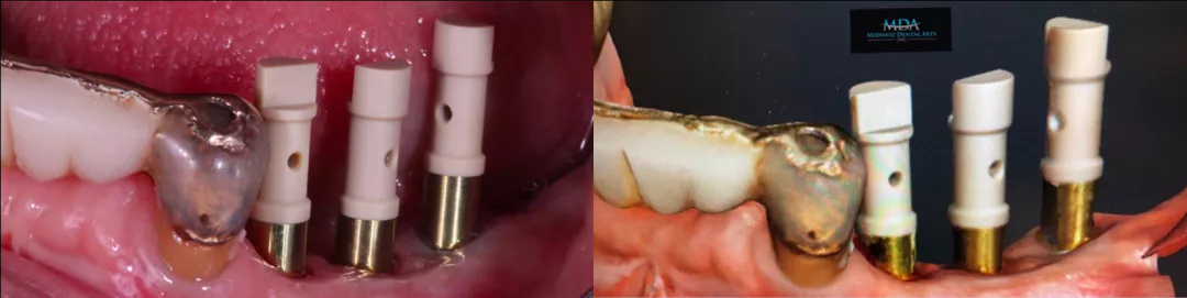 美迪特重拳出击 | 三星、奔驰、华为使用的3D扫描仪技术进入牙科行业了！