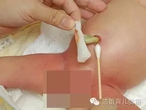 养育孩子不是在维护精密仪器——脐带护理那些事！