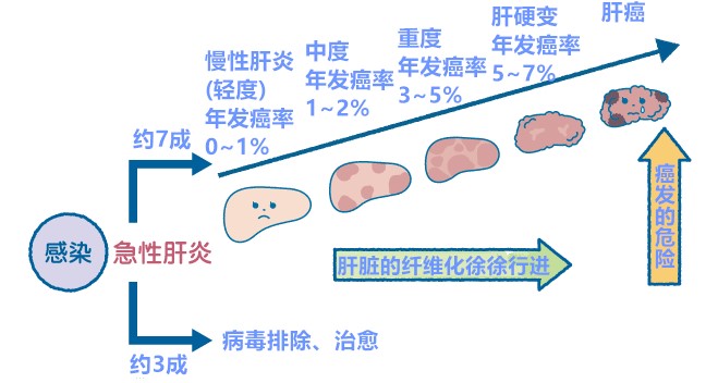 丙肝不容小觑，治疗需及时