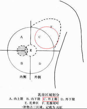 自查三部曲 JMS带你远离乳腺癌