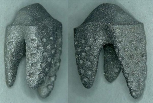 德国NDI展示可定制的低成本3D打印金属假牙