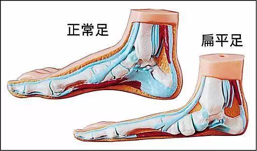 轮滑常识 | 足部的疼痛与解决办法