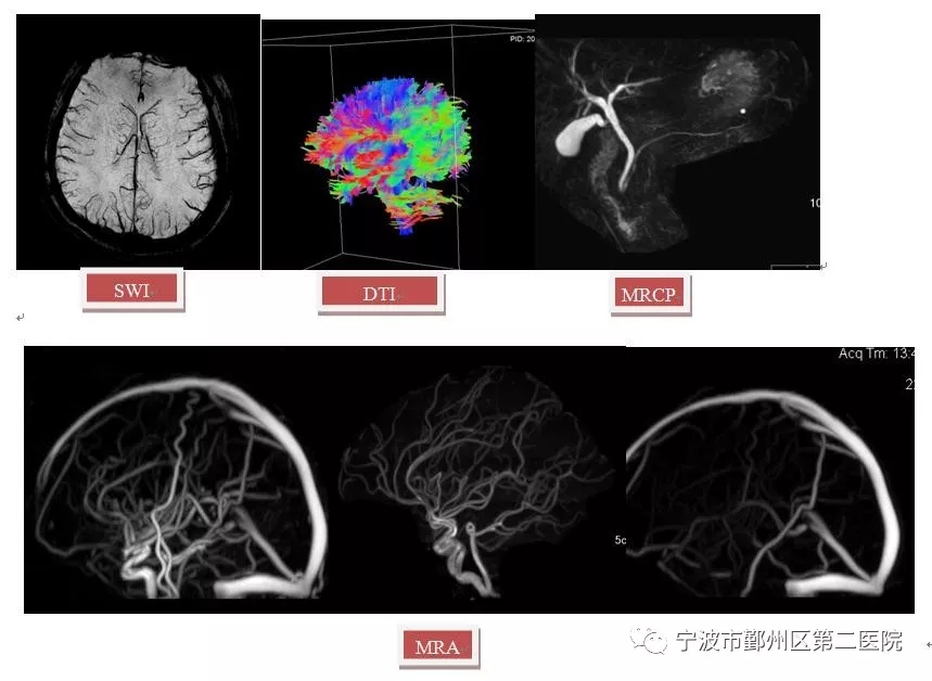 國產磁共振巔峰之作來了！鄞州二院影像檢查又添新設備