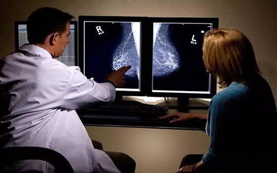 什么年龄开始乳腺癌筛查？查什么？