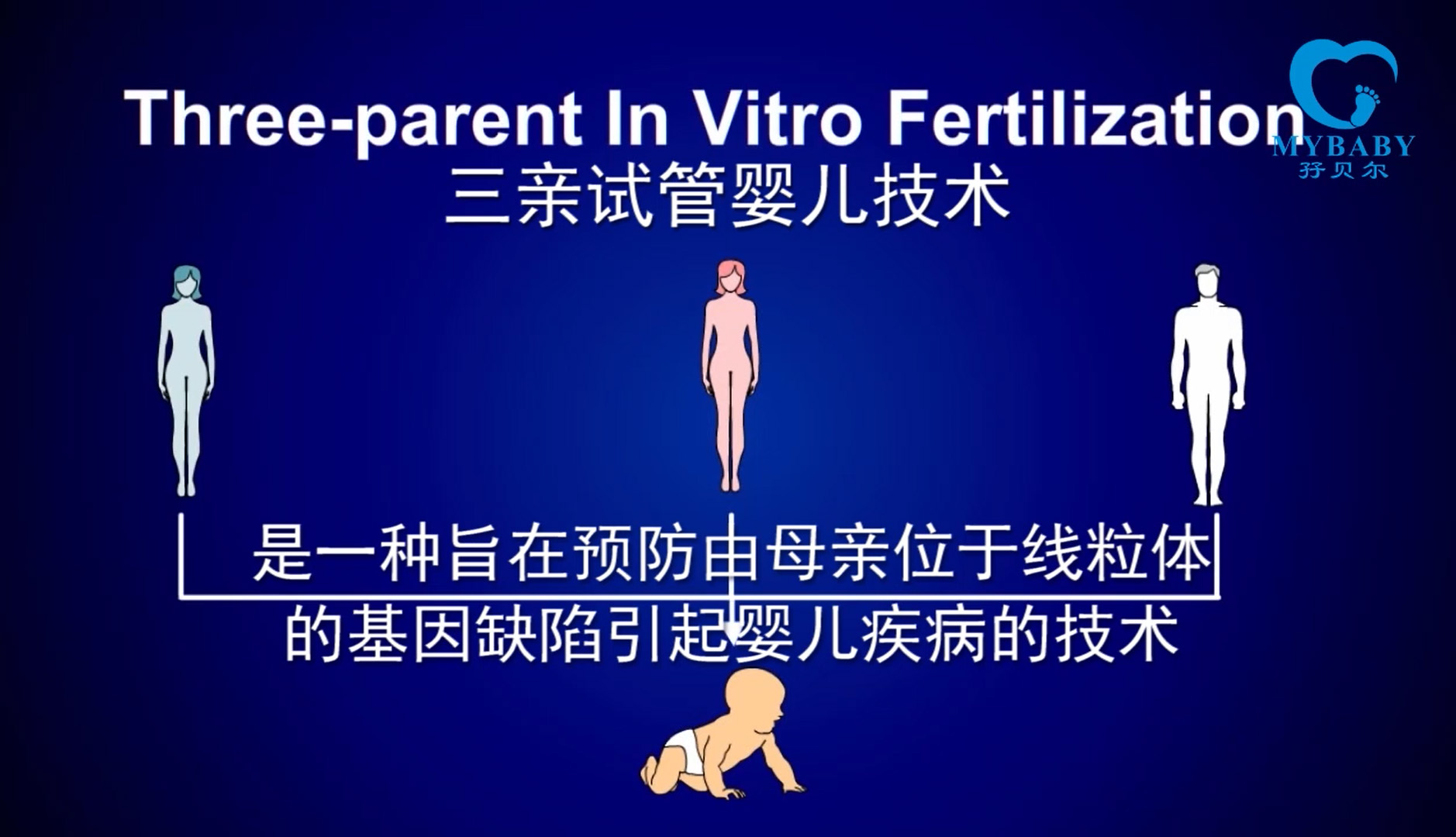 赠卵试管婴儿的操作流程详解，赠卵试管婴儿的具体流程