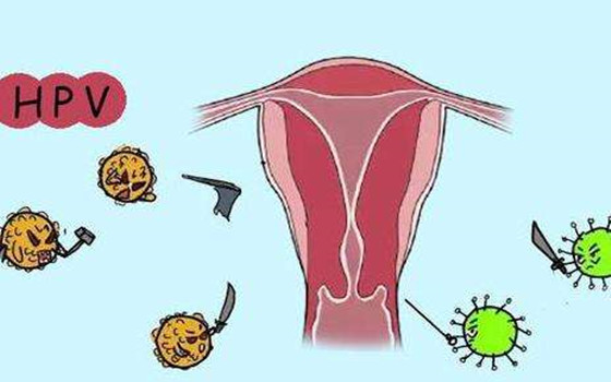HPV感染的主要影响因素