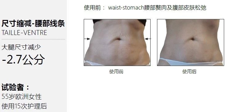 法国LPG用30分钟解救新年来多日的放纵