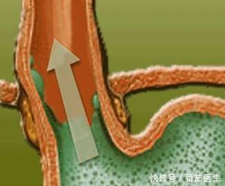 哪些不良习惯能够导致颈椎病 哪些不良习惯能够导致颈椎病
