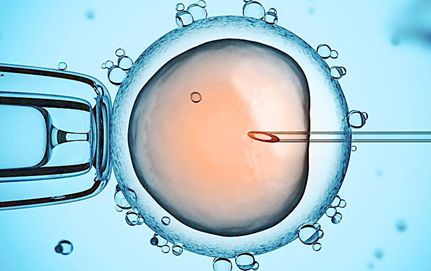 胚胎植入前遺傳學篩查