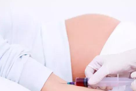 【无创DNA】孕妇做产前检测的好处是什么