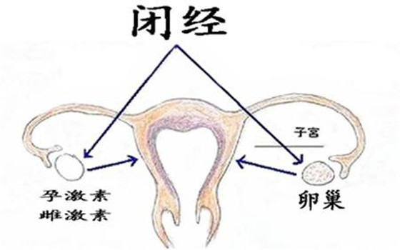 婦潔抑菌凝膠解析  女性閉經(jīng)的危害有哪些？