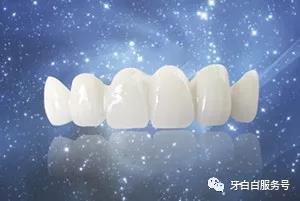 水晶瓷贴面 水晶瓷贴面