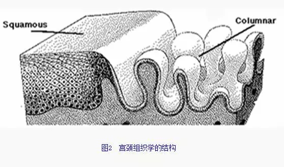 婦潔抑菌凝膠學(xué)術(shù)  一個(gè)過(guò)時(shí)的婦科疾病---宮頸糜爛