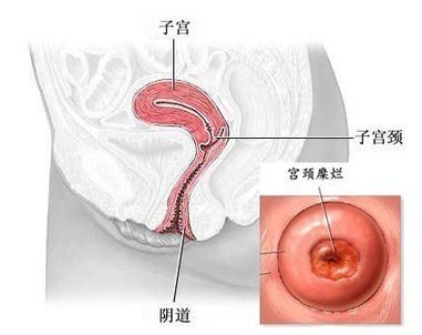 婦科凝膠廠家學(xué)術(shù)  那些所謂的婦科“病”其實(shí)根本不用治療