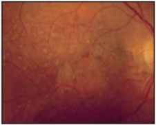 RS-330眼科光学相干断层扫描仪