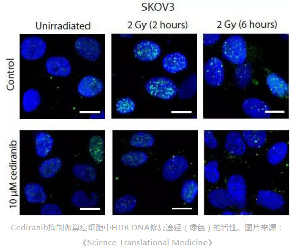 耶鲁科学家确定抗癌药如何抑制癌细胞的DNA修复