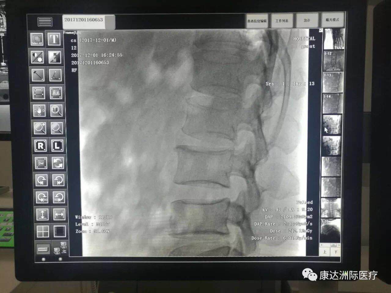 积水潭骨科专家背书康达天目平板小C