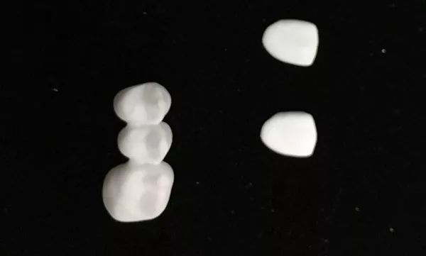创新运用陶瓷|3D打印氧化锆全瓷假牙 创新运用陶瓷|3D打印氧化锆全瓷假牙
