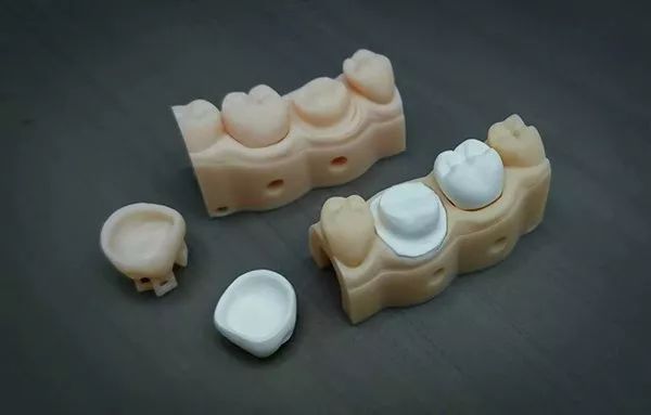 创新运用陶瓷|3D打印氧化锆全瓷假牙 创新运用陶瓷|3D打印氧化锆全瓷假牙
