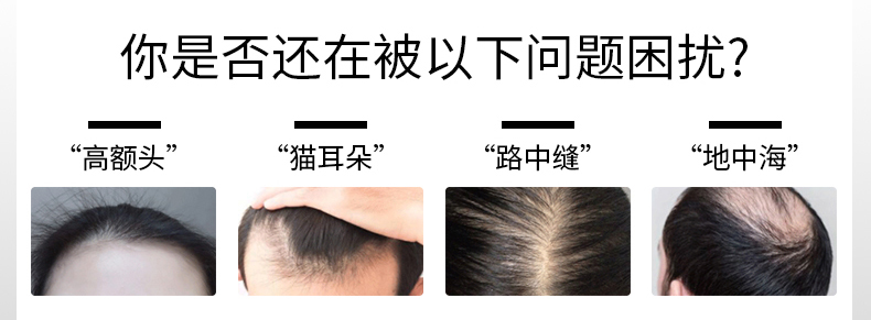 绿昂长长颗粒，拯救脱发危机！