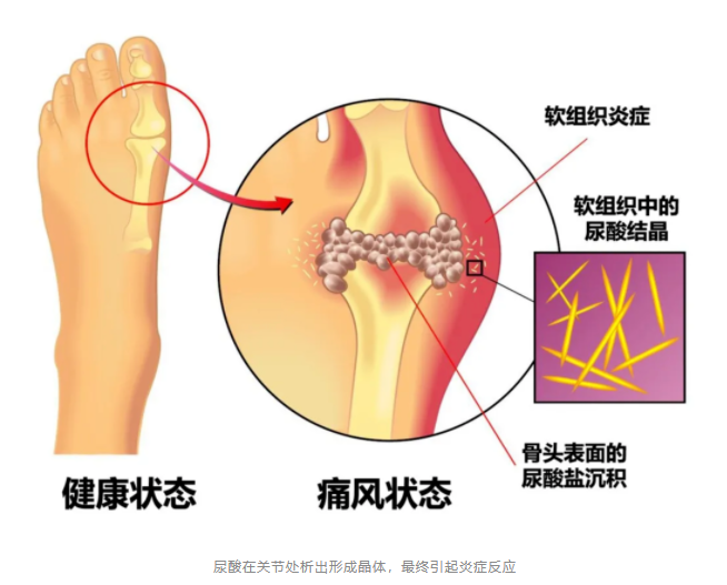 你身体里有一种针，比容嬷嬷的针还厉害