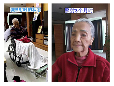 86岁褥疮老人的奇迹康复 ——全科治疗仪是家庭医生的好助手 86岁褥疮老人的奇迹康复 ——全科治疗仪是家庭医生的好助手