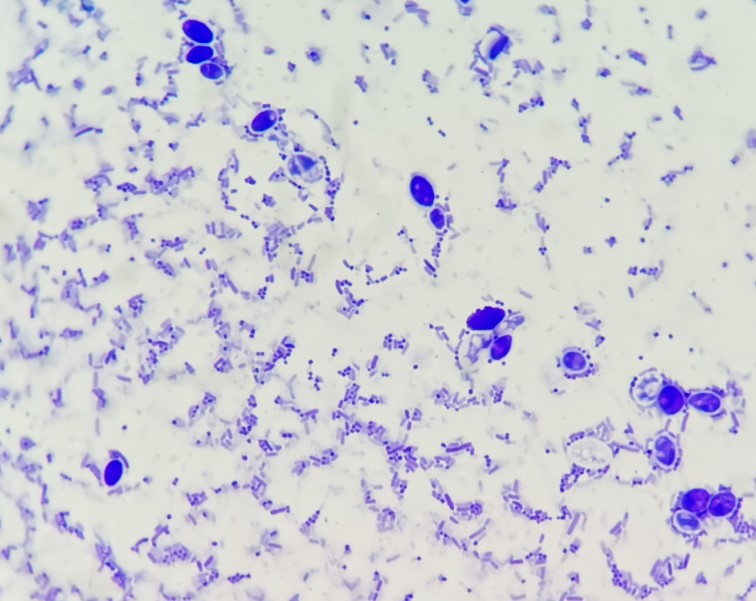 微生物检验中常用的染色方法介绍