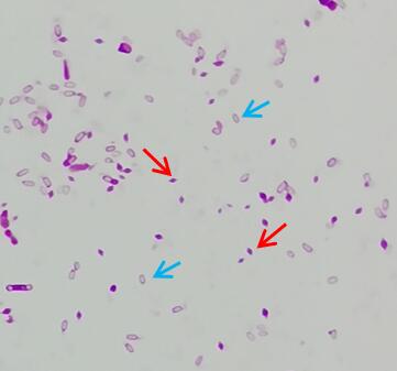 微生物检验中常用的染色方法介绍