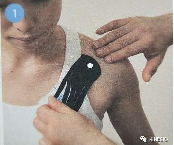 kinesio 之凝肩篇：过度使用手腕引起的肩部不适