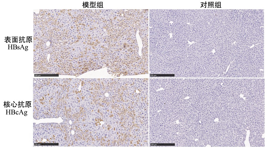 HBV致肝纤维化小鼠模型诱导剂