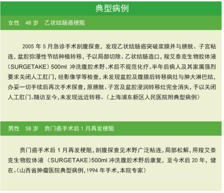 Eims-智能家居風扇 Eims-智能家居風扇