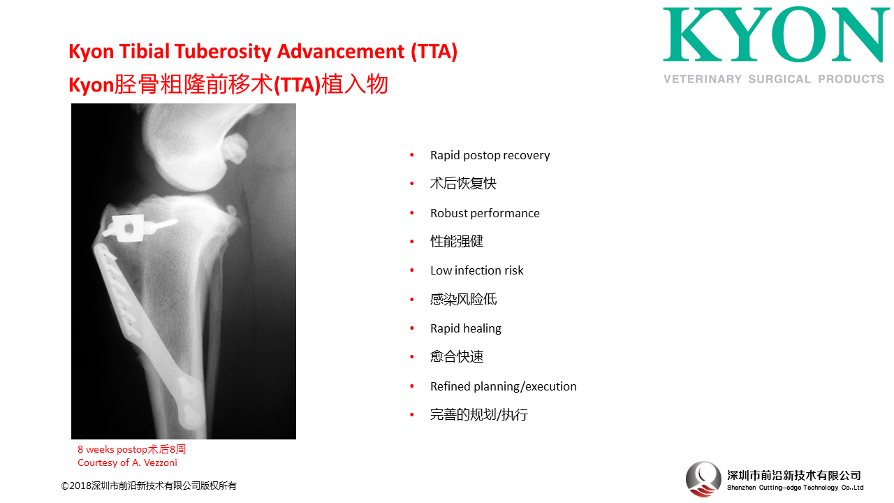 瑞士Kyon Tibial Tuberosity Advancement (TTA) 胫骨粗隆前移术