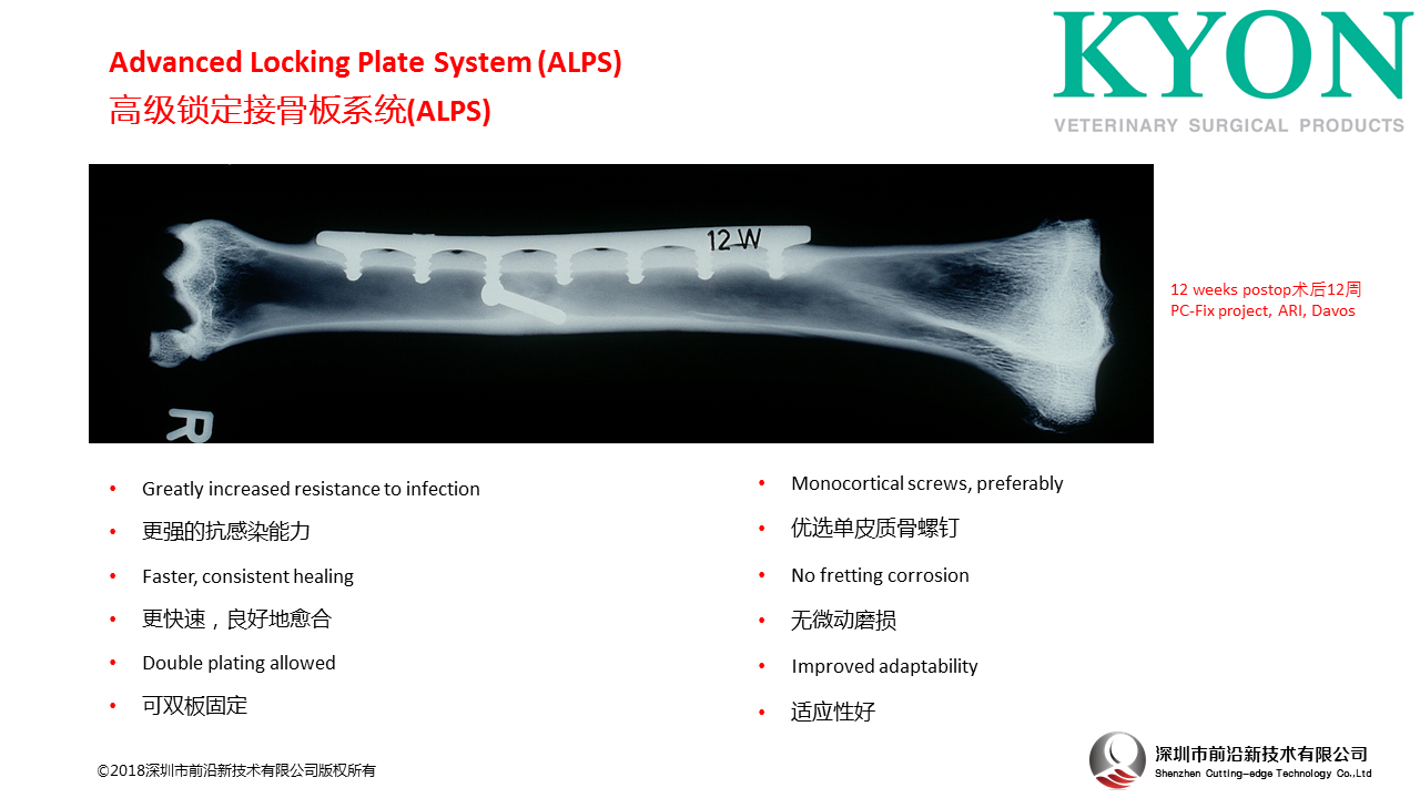 瑞士Kyon Advanced Locking Plate System (ALPS)高级锁定板系统ALPS