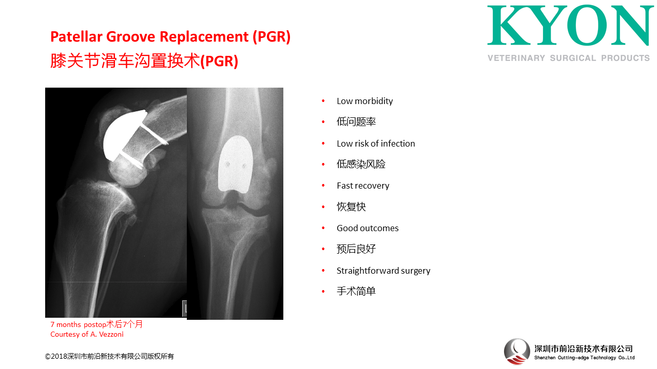 瑞士Kyon Patellar Groove Replacement (PGR)膝关节滑车沟置换术