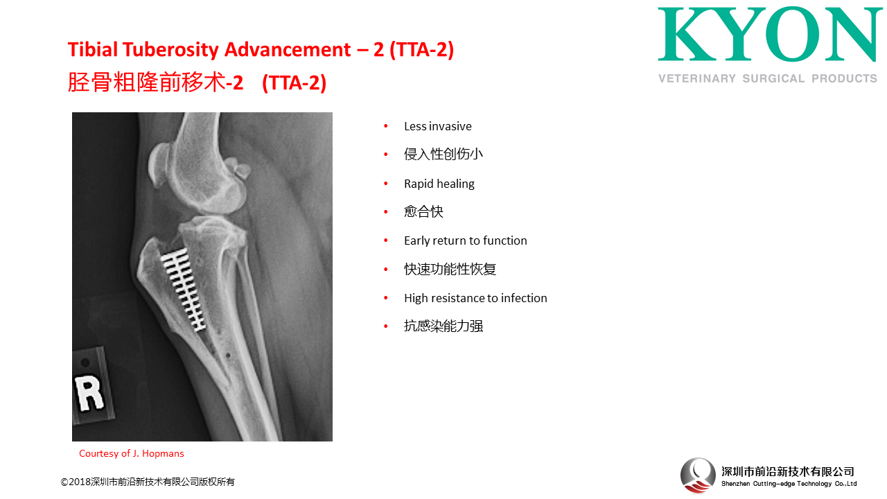 瑞士Kyon Tibial Tuberosity Advancement – 2 (TTA-2) 胫骨粗隆前移术-2